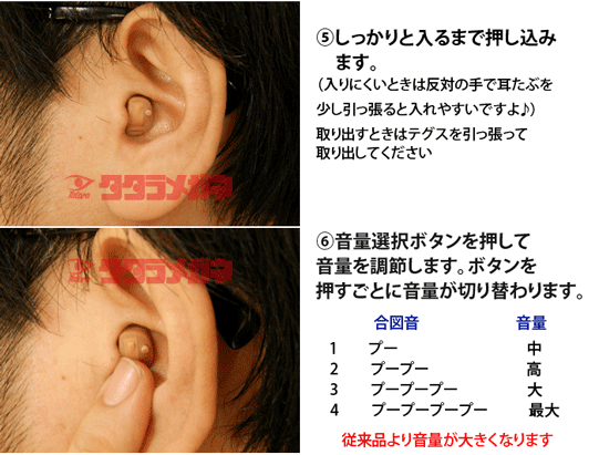 デジミミ3 左耳 耳穴形デジタル補聴器